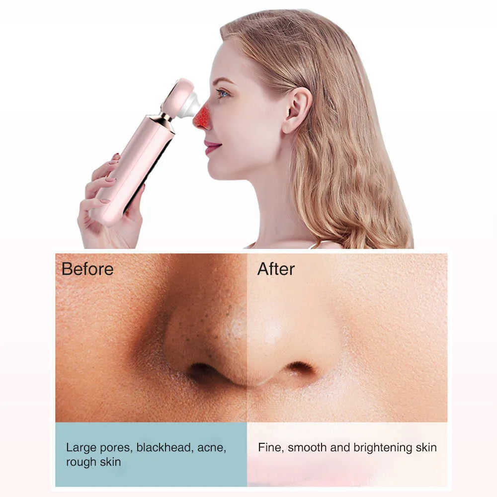 𝙓 𝙂𝙪𝙡𝙛 𝙈𝙖𝙧𝙩™ Blackhead Suction Machine | جهاز شفط الرؤوس السوداء
