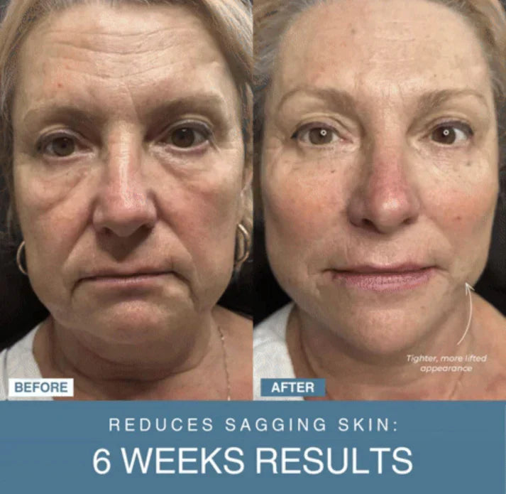 𝙓 𝙂𝙪𝙡𝙛 𝙈𝙖𝙧𝙩™ 7-in-1 LED Anti-Aging/Wrinkle Apparatus