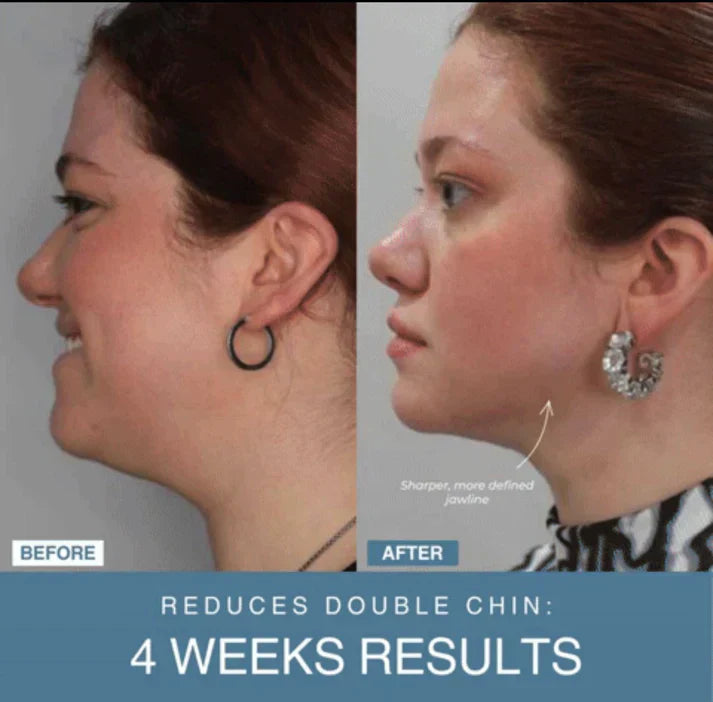 𝙓 𝙂𝙪𝙡𝙛 𝙈𝙖𝙧𝙩™ 7-in-1 LED Anti-Aging/Wrinkle Apparatus