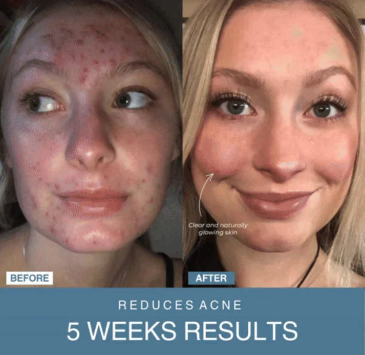 𝙓 𝙂𝙪𝙡𝙛 𝙈𝙖𝙧𝙩™ 7-in-1 LED Anti-Aging/Wrinkle Apparatus